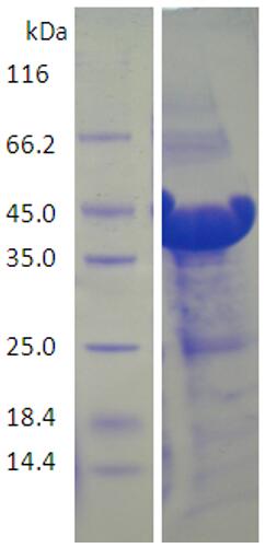 15% SDS-PAGE analysis profiles of purified KP1_4374-27-376 (CBB stained).
